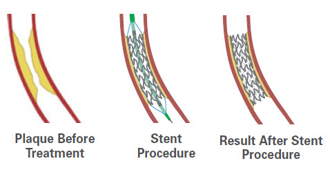 Fig.2